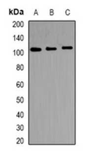 1 - Anti-TRAK2 Antibody ABV11880