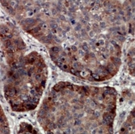 2 - Anti-TRAPPC5 Antibody ABV11881
