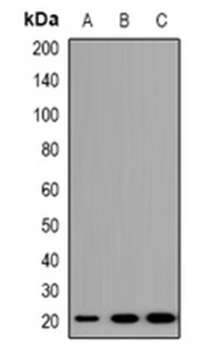 1 - Anti-TRAPPC5 Antibody ABV11881