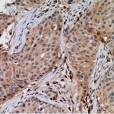 2 - Anti-UBE2G1 Antibody ABV11884