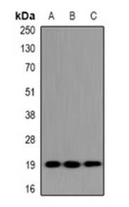 1 - Anti-UBE2G1 Antibody ABV11884