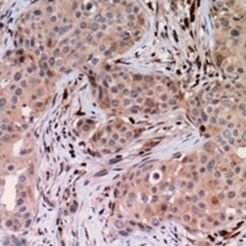 2 - Anti-USP6NL Antibody ABV11885