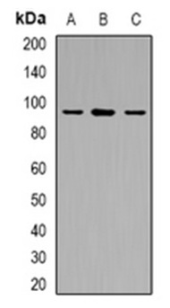 1 - Anti-USP6NL Antibody ABV11885