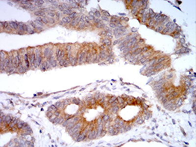 2 - Mouse Monoclonal Antibody to VIMP AO2378a