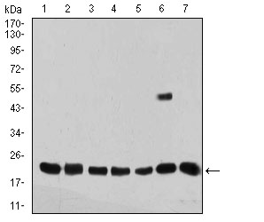 1 - Mouse Monoclonal Antibody to VIMP AO2378a