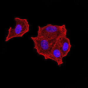 8 - Mouse Monoclonal Antibody to PTPN14 AO2383a
