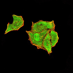 8 - Mouse Monoclonal Antibody to PTPN14 AO2383a