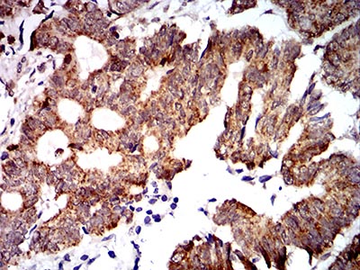 2 - Mouse Monoclonal Antibody to PTPN14 AO2383a