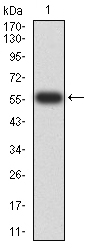 1 - Mouse Monoclonal Antibody to PTPN14 AO2383a