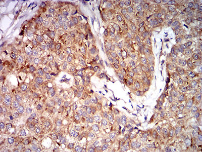 2 - Mouse Monoclonal Antibody to EIF5 AO2386a