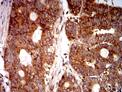 2 - Mouse Monoclonal Antibody to EIF5 AO2386a