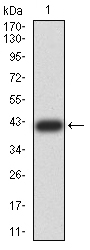 1 - Mouse Monoclonal Antibody to CDCP1 AO2415a