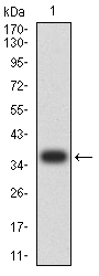1 - Mouse Monoclonal Antibody to MUC5AC AO2433a