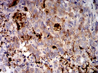 2 - Mouse Monoclonal Antibody to MUC5AC AO2434a