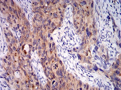 2 - Mouse Monoclonal Antibody to C1QA AO2438a
