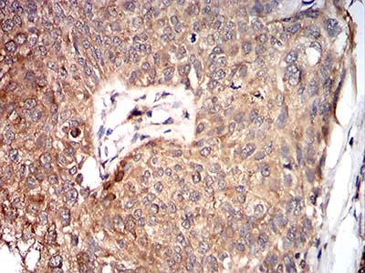 2 - Mouse Monoclonal Antibody to VP2 AO2440a