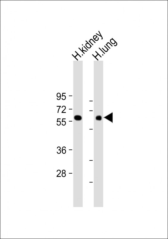 1 - MKS1 Antibody (N-Term) AP22330a