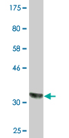 1 - CSAD monoclonal antibody (M01A), clone 1D2 AT4668a