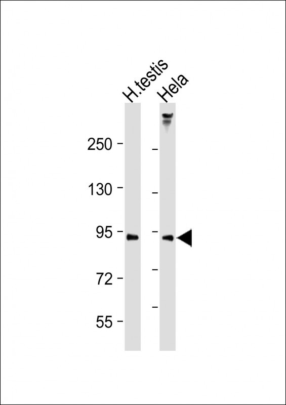 1 - LOXL4 Antibody (C-term) AP17245b