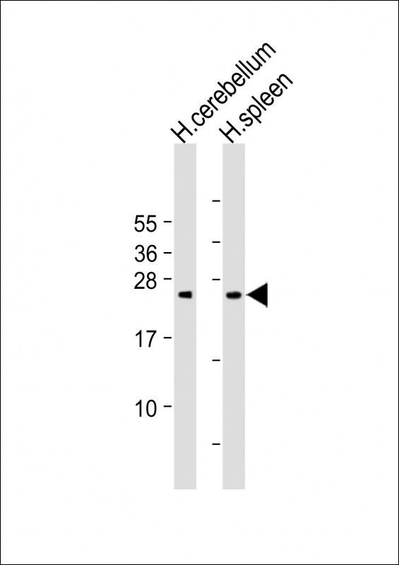 1 - GCA Antibody (N-Term) AP22336a