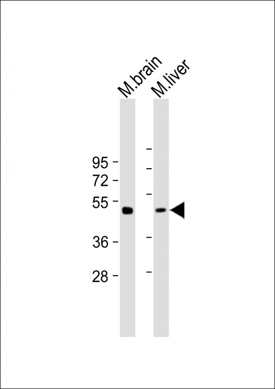 1 - gamma Tubulin Antibody AP22339a