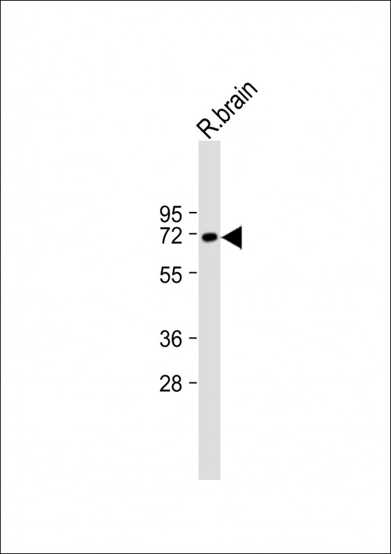 1 - SLC17A6 Antibody (Center) AP22344c