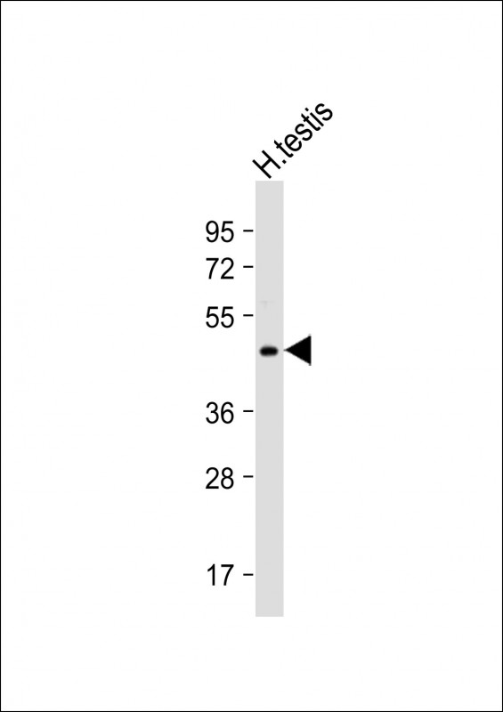 1 - UBXN6 Antibody  (C-term) AP5085b