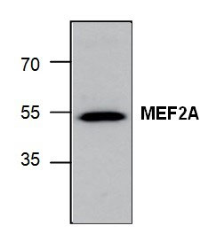 1 - MEF2A Antibody ABV11887
