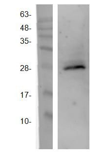 1 - TGF-β1 Antibody ABV11889