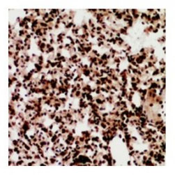 2 - Anti-ZNF600 Antibody ABV11925
