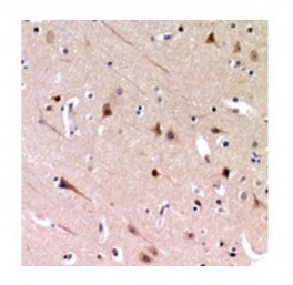 2 - Anti-ZNF839 Antibody ABV11928