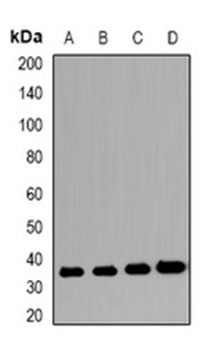 1 - Anti-VSIG2 Antibody ABV11929