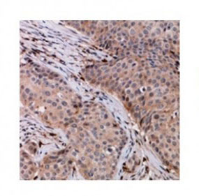 2 - Anti-VPS54 Antibody ABV11931
