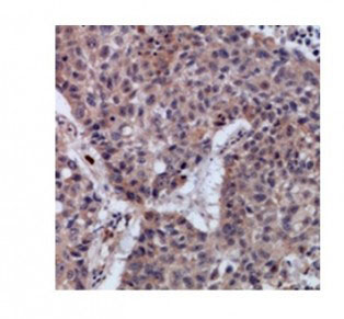 2 - Anti-SETMAR Antibody ABV11932