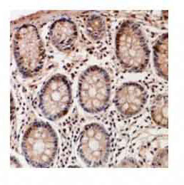 2 - Anti-TSSK6 Antibody ABV11933