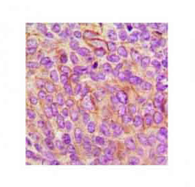 2 - Anti-LILRB5 Antibody ABV11935