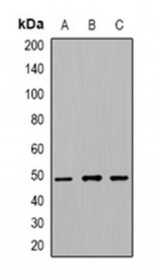 1 - Anti-Beta-tubulin Antibody ABV11947