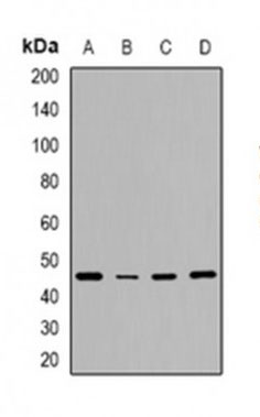 1 - Anti-RhD Antibody ABV11948
