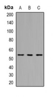 1 - Anti- THNSL2 Antibody ABV11949