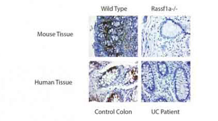2 - RASSF1A Antibody ABV11952