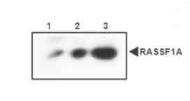 1 - RASSF1A Antibody ABV11952