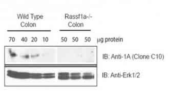 1 - RASSF1A Antibody ABV11952