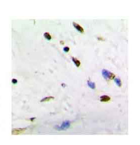 2 - Anti-ADNP Antibody ABV11957