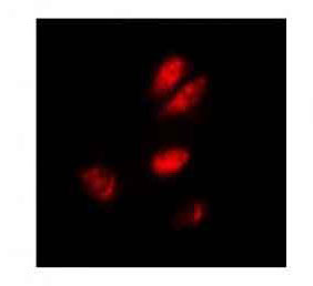 3 - Anti-ASF1A Antibody ABV11958