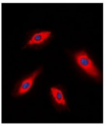 3 - Anti- ALPK1 Antibody ABV11960