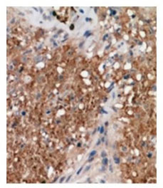 2 - Anti- ALPK1 Antibody ABV11960