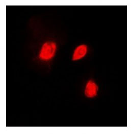 3 - Anti-EID1 Antibody  ABV11961