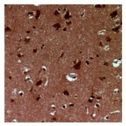 2 - Anti-EID1 Antibody  ABV11961