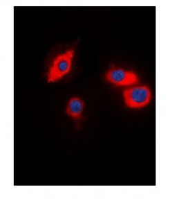 3 - Anti-CIDEB Antibody ABV11962