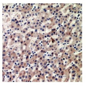 2 - Anti-CIDEB Antibody ABV11962